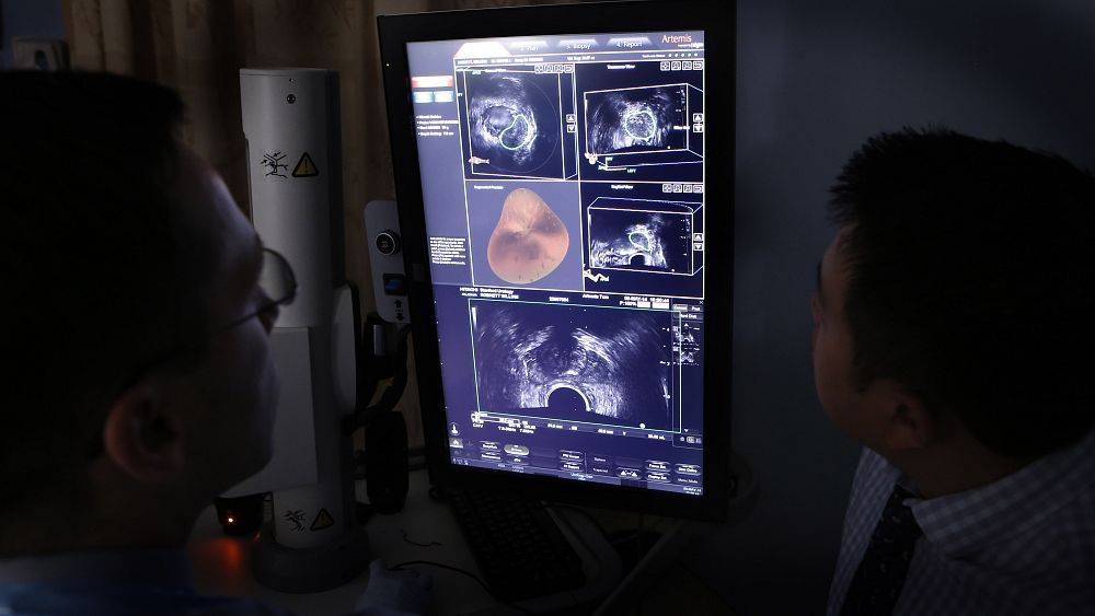 Skany MRI w kierunku raka prostaty mogą doprowadzić do znacznego zmniejszenia liczby zgonów u mężczyzn powyżej 50 roku życia, wynika z nowych badań