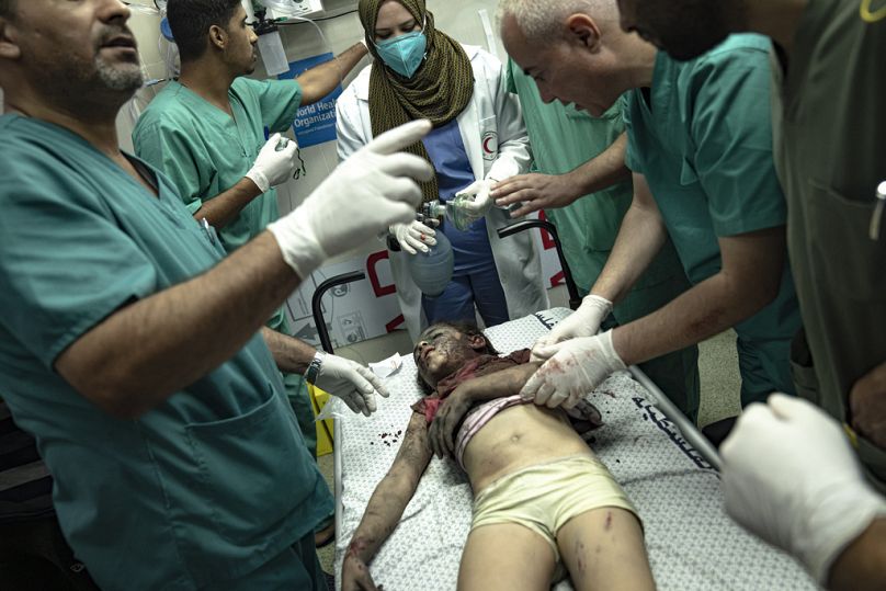 Młoda palestyńska dziewczyna jest leczona w szpitalu po tym, jak została ranna w wyniku izraelskiego bombardowania Strefy Gazy w Khan Younis, poniedziałek, 6 listopada 2023 r.