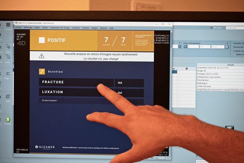 Lekarz patrzy na ekran wspomagany sztuczną inteligencją do obrazowania medycznego, który wskazuje możliwe złamania i zwichnięcia kości w szpitalu uniwersyteckim w Rennes, wrzesień 2023 r.