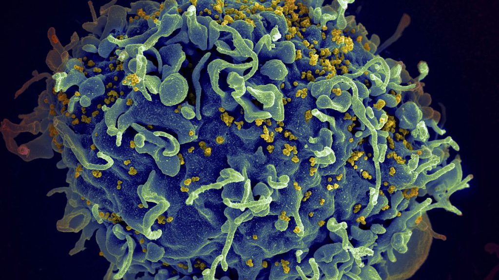 This electron microscope image shows a human T cell, in blue, under attack by HIV, in yellow, the virus that causes AIDS.