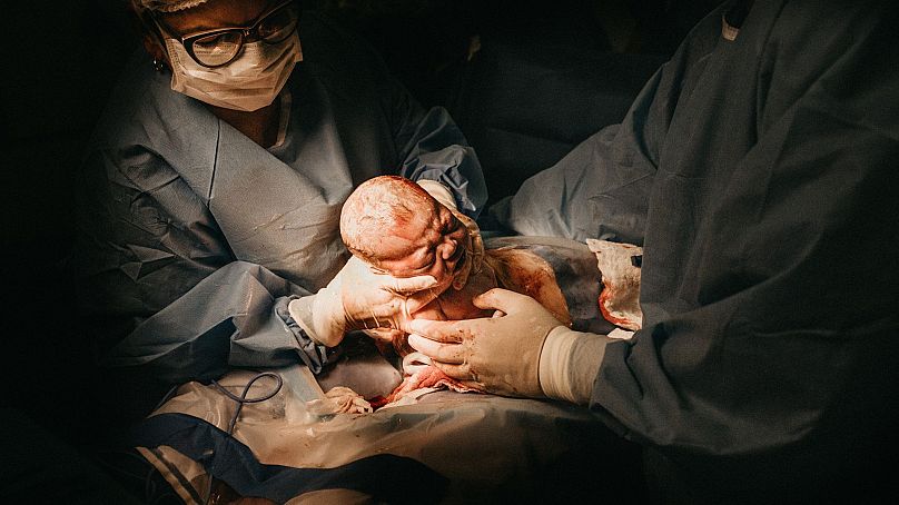 Kobieta rodzi dziecko przez cesarskie cięcie